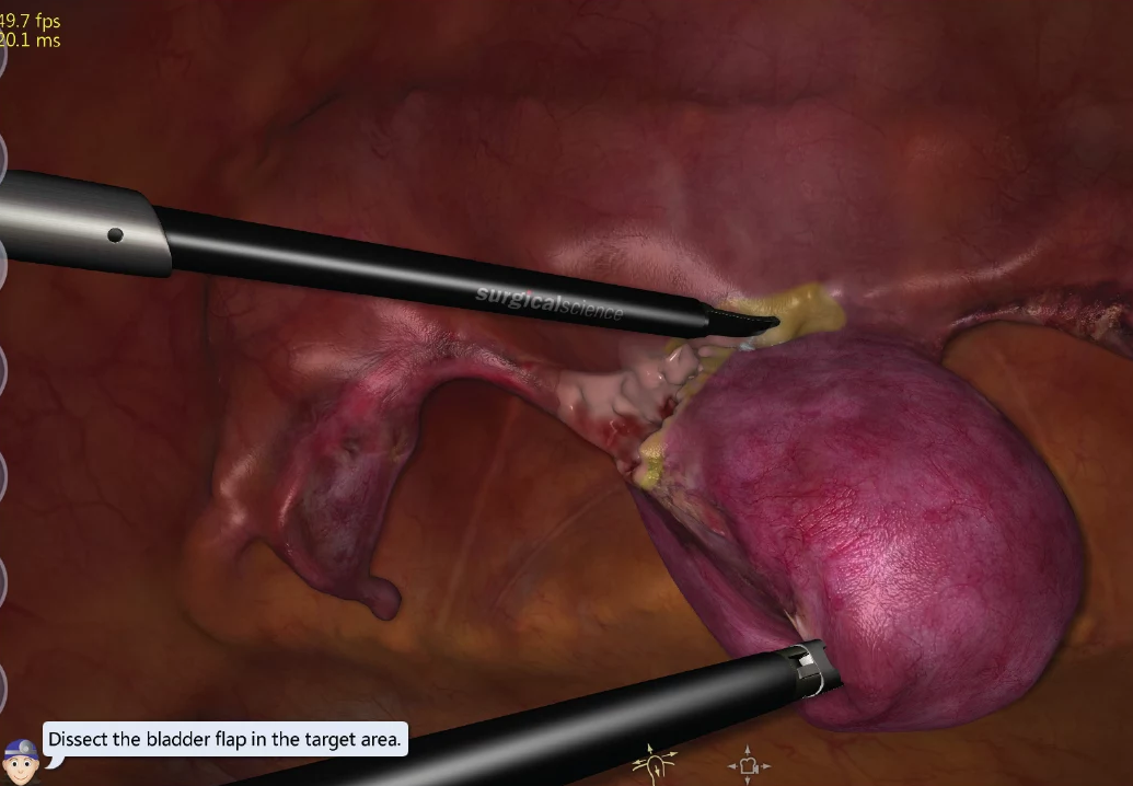 The Role of Surgical Simulation in Contemporary OB/GYN Training