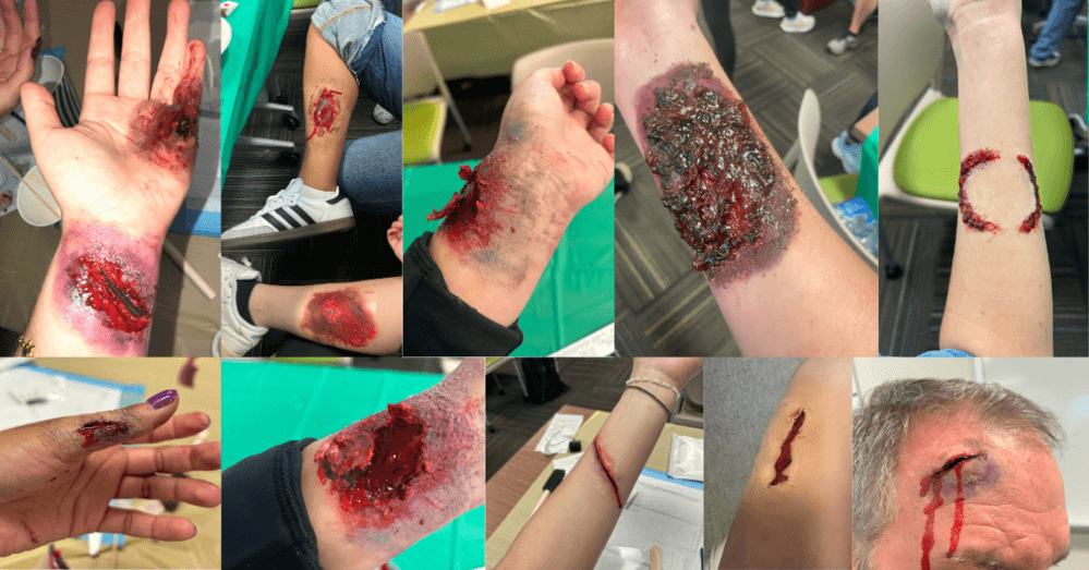 How to Develop Moulage Skills for Medical Simulation